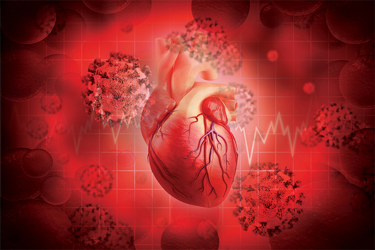 COVID-19 gây tim đập nhanh, hồi hộp thông qua nhiều cơ chế khác nhau